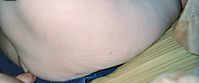 fatty15.jpg